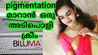 Pigmentation മാറാൻ ഒരു അടിപൊളി ക്രീം All about biluma cream Uses sideeffects skin whitening [upl. by Sherrard]