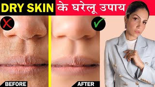 Dry Skin Care in Winter  Home Remedies to Moisturize Skin Naturally  रूखी त्वचा के घरेलू उपाय [upl. by Tiersten]