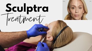 Revitalize Your Look The Ultimate Guide to Sculptra Treatments [upl. by Misa873]