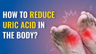 Uric Acid Symptoms and Treatment  How to Reduce Uric Acid in the Body  MFine [upl. by Elhsa]