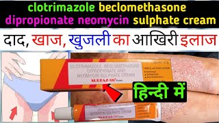 clotrimazole beclomethasone dipropionate neomycin sulphate cream uses in hindi  surfaz sn cream [upl. by Treblihp]