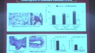 AAA Insights from the ElastaseInduced Rodent Model [upl. by Leiahtan889]