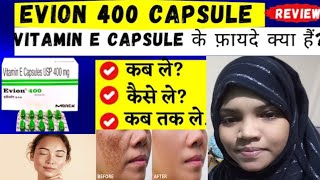 vitamin e capsules evion 400 capsules for face pigmentation pimples ko kese thik karta hai [upl. by Aran894]