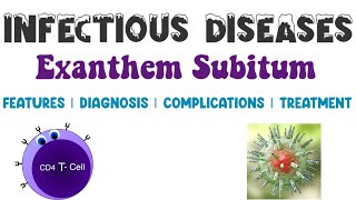 Exanthem Subitum  Viral Infections  Infectious Diseases 4  Medicine [upl. by Druce960]