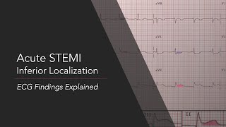 Acute Inferior STEMI ECG Findings Explained [upl. by Dusty]