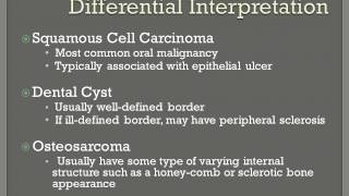 Fibrosarcoma [upl. by Farica409]