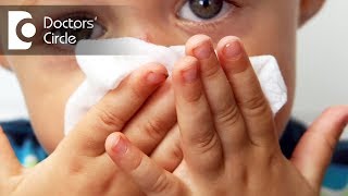 Treatment for frequent cold congestion and watery eyes in children  Dr Vivekanand M Kustagi [upl. by Barker]