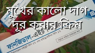 ত্বকে Fungidal HC cream এর কাজ কি  ব্রণ সহ ত্বকের যে কোন সমস্যায় ক্রিম টি ব্যবহার করার নিয়ম [upl. by Eca]