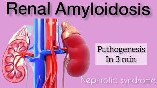 Renal amyloidosis  pathogenesis [upl. by Maurilia]