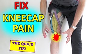 How To Fix Pain In The Front Of The Knee Runners knee [upl. by Eiuqram]