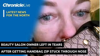 Beauty salon owner left in tears after getting handbag zip stuck through nose [upl. by Popele]