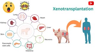 Xenotransplantation Research  Where Are We At 3 Minutes Microlearning [upl. by Lleynod]