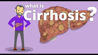 Cirrhosis  What is cirrhosis [upl. by Anigal]