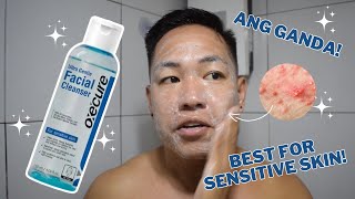 OXECURE ULTRA GENTLE FACIAL CLEANSER REVIEW FOR ONE MONTH  BEST FOR SENSITIVE SKIN AND BREAKOUTS [upl. by Drageruaeb524]