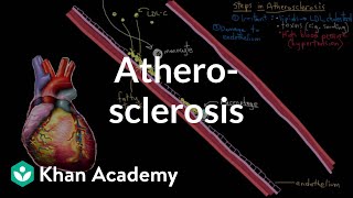 Atherosclerosis  Circulatory System and Disease  NCLEXRN  Khan Academy [upl. by Gertruda]