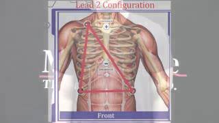 Electrode Placement Training for Electrocardiogram ECG [upl. by Jackqueline38]