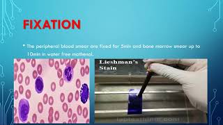 leishman stain procedure [upl. by Fosdick327]