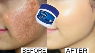 Vaseline for face pigmentation overnight  Vaseline on face at night benefits  Vaseline on face [upl. by Dominick547]