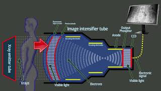 Fluoroscopy  Xray intensifier tube  Basic functions [upl. by Andros]