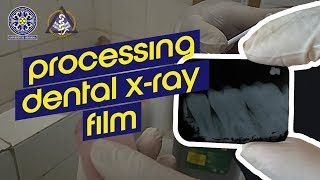 Periapical Dental XRay Film Processing [upl. by Daley]