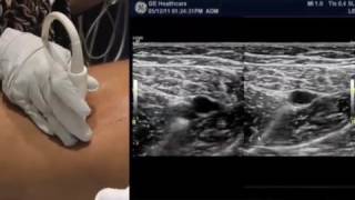 How To Lower Extremity Ultrasound [upl. by Enyt852]