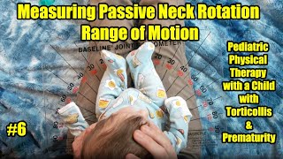 6 Measuring Passive Neck Rotation Range Pediatric PT with a Child with Torticollis amp Prematurity [upl. by Ecaidnac]