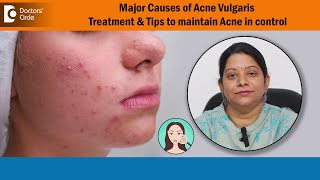 How to Treat Acne Vulgaris on face Tips to keep Acne in control  DrVani Yepuri  Doctors Circle [upl. by Yedarb726]