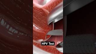 HPV Test 3D Animation [upl. by Asyla578]