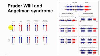 72 Impriting and Imprinting Disorders  Prader Willi and Angelman Syndroes [upl. by Nosnej140]