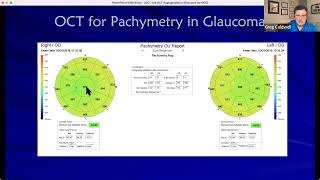 OCT and OCT Angiography for Glaucoma [upl. by Kiona53]