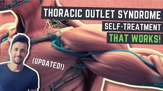 Thoracic Outlet Syndrome Treatment That WORKS Updated [upl. by Zirtaeb]