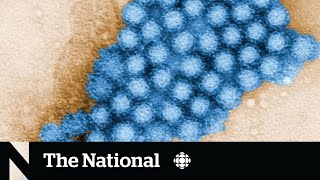 Cases of stomachbug causing norovirus on the rise in Canada [upl. by Ellenaej]