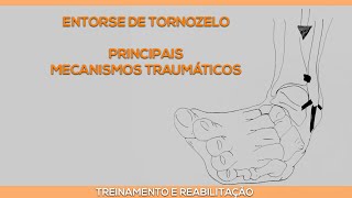 Entorse de tornozelo e seus mecanismos traumáticos [upl. by Notseh443]