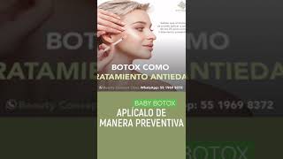 👶🏻💉 Elimina Líneas de marioneta y código de barras con BABY BOTOX [upl. by Mirilla]