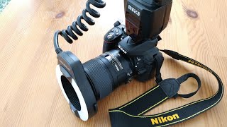 Dental Photography Settings for Nikon Camera DSLR [upl. by Edmond]