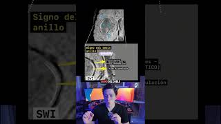 Absceso vs tumor Glioblastoma por resonancia magnética mri tumor cerebro radiologia [upl. by Vally]