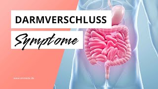 Darmverschluss Typische Symptome eines Ileus [upl. by Eninej888]