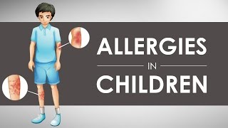 Allergies in Children I 1 [upl. by Kayley]