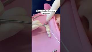 Resina composta 💛 dentista dentistas odontologia dentes faceta facetadental odonto [upl. by Evilo]