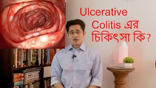 What is ulcerative colitis Ulcerative colotis কি [upl. by Neelloc]