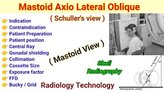 Mastoid Axio Lateral Oblique view  Schullers View in Hindi  Mastoid View [upl. by Avi256]