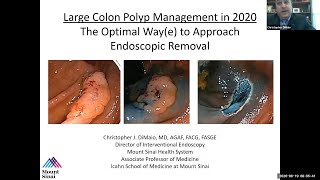 Large Colon Polyp Management in 2020 The Optimal Waye to Approach Endoscopic Removal [upl. by Analrahc]