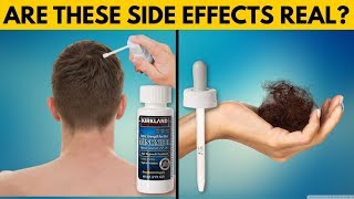 REAL TRUTH About Minoxidil Side Effects [upl. by Wolram989]