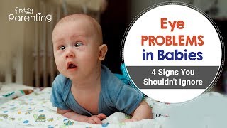 Common Eye Problems in Babies  Causes Symptoms and Treatment [upl. by Bartie509]