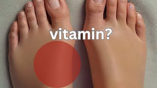 1 Vitamin to Say Goodbye to Swollen Feet and Legs [upl. by Alyosha]