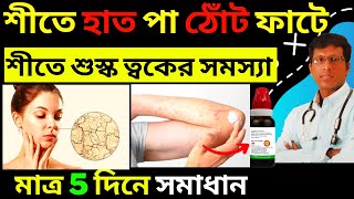 শীতে শুষ্ক ত্বক হাত পা ও ঠোঁট ফাটা দূর করার উপায় Homeopathic Remedies for Cracked Skin [upl. by David]