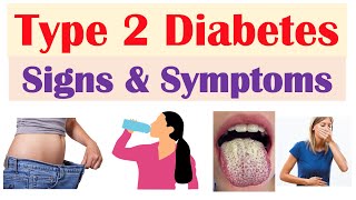 Type 2 Diabetes Signs amp Symptoms amp Why They Occur amp Associated Conditions [upl. by Ad]