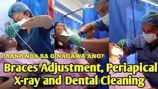 DENTAL CLEANING BRACES ADJUSTMENT AND PERIAPICAL XRAY PAANO NGA BA GINAGAWA [upl. by Ikkin]