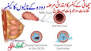 Ductal Carcinoma in Situ DCIS  Successful Natural Treatment of Breast Cancer [upl. by Rukna]