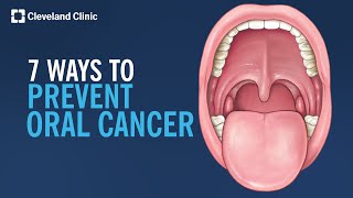 7 Ways to Prevent Oral Cancer [upl. by Kcered]